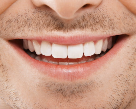Transform seu sorriso dra natáli ferrari