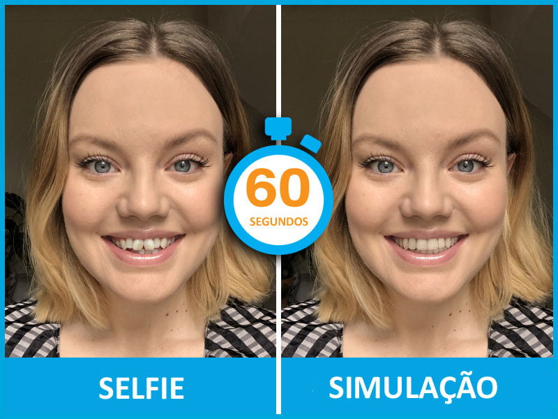 transforme seu sorriso com invisalign